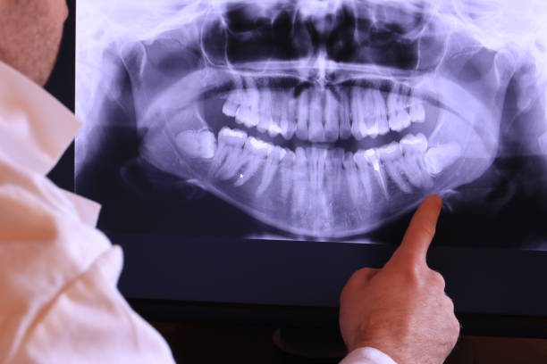 Best Emergency Gum Treatment in Iowa, LA