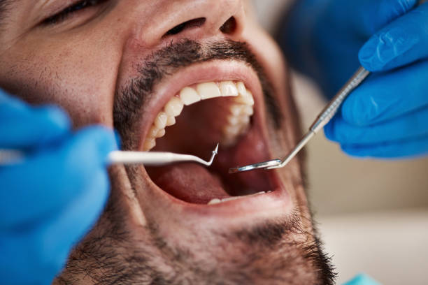 Best Same-Day Emergency Dental Services in Iowa, LA